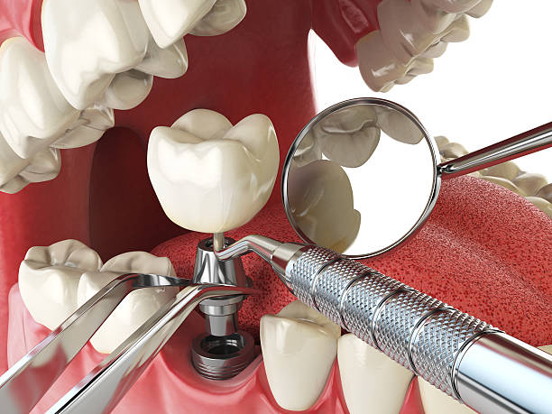Best Emergency Dental Services for Seniors in North Richland Hills, TX