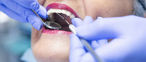 Best Emergency Dental Care for Abscessed Tooth in North Richland Hills, TX