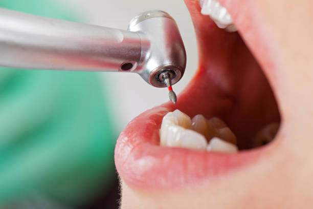 Best Orthodontic Emergency Dentist in North Richland Hills, TX